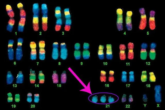 Why Wear Colorful Socks on World Down Syndrome Day March 21?