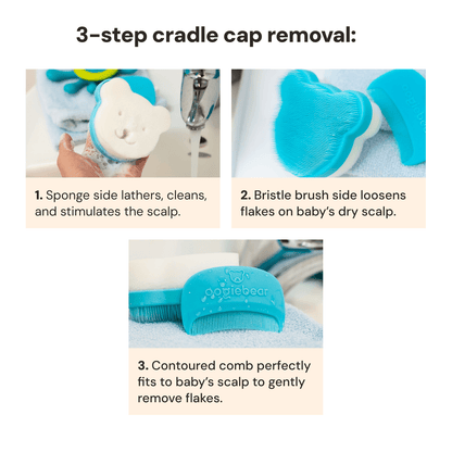 3-step cradle cap removal process with a baby grooming tool on a white background.